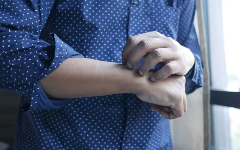 A man in a polka dot shirt scratching his arm next to a window, symbolizing discomfort or irritation.