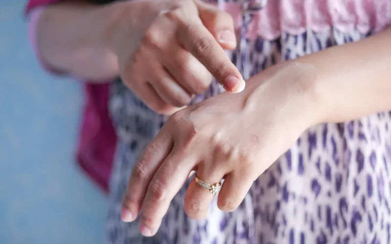 A woman applies skincare cream on her hand, highlighting moisturizing routine.