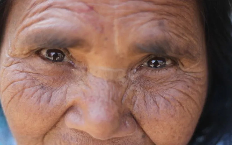Dlaczego Dłonie Szybko Się Starzeją? 7 Codziennych Nawyków Anti-Aging, Które Musisz Zmienić