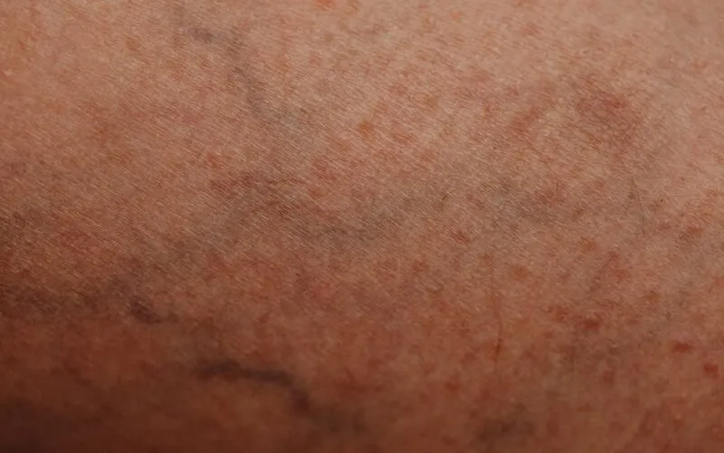 Jak Wybrać Najlepsze Składniki w Kremie do Rąk? Poradnik Eksperta po INCI