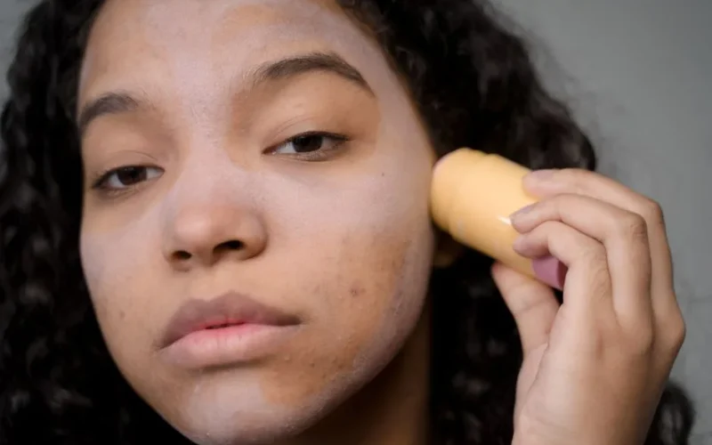 Close-up portrait of a woman applying skincare product to address acne and improve skin texture.